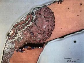 Photographs 1 Fitting Cross Sections Showing Plug Type (1) And Layer Type (2) Dezincification